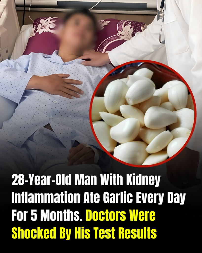He Ate Garlic Every Day for 5 Months — What Happened to His Kidneys Surprised Doctors 😳
